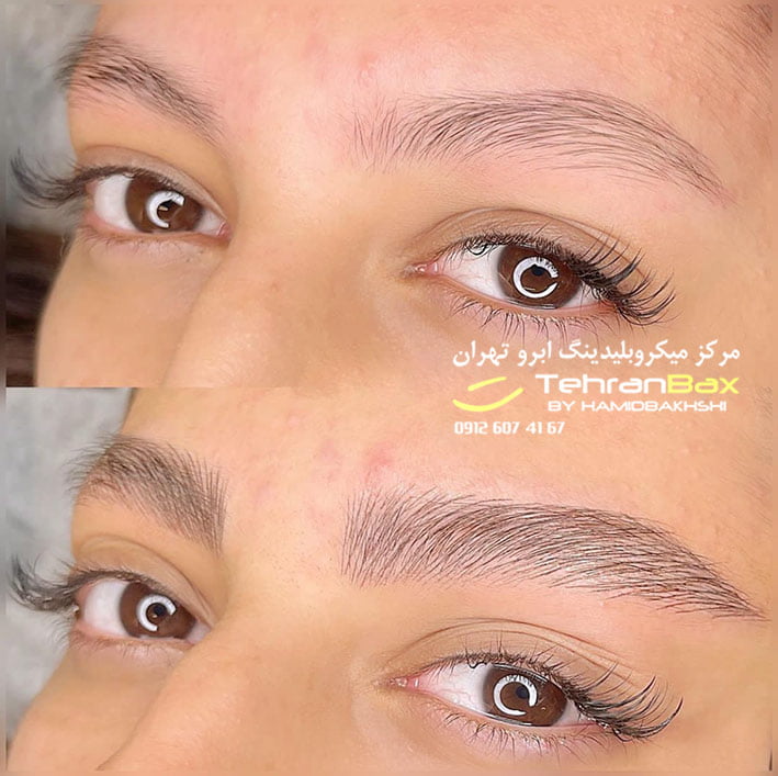 میکروبلیدینگ ابرو مردانه