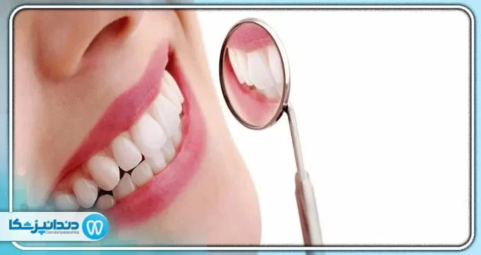 Does scaling damage the teeth