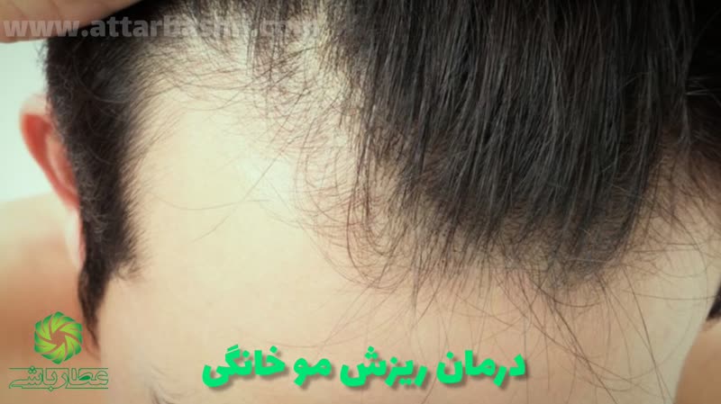 درمان ریزش مو خانگی-عطارباشی