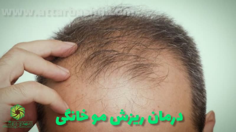 درمان ریزش مو خانگی_عطارباشی