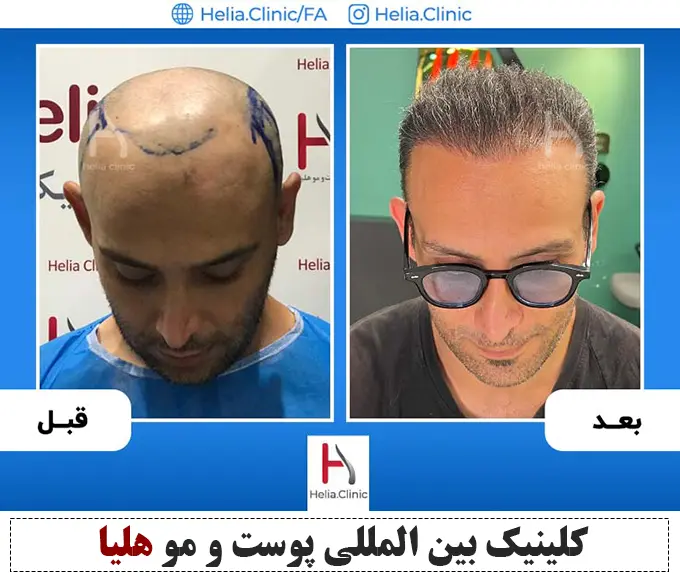 https://akharinnews.com/images/1403/03/15/%DB%B2%DB%B2%DB%B2.png