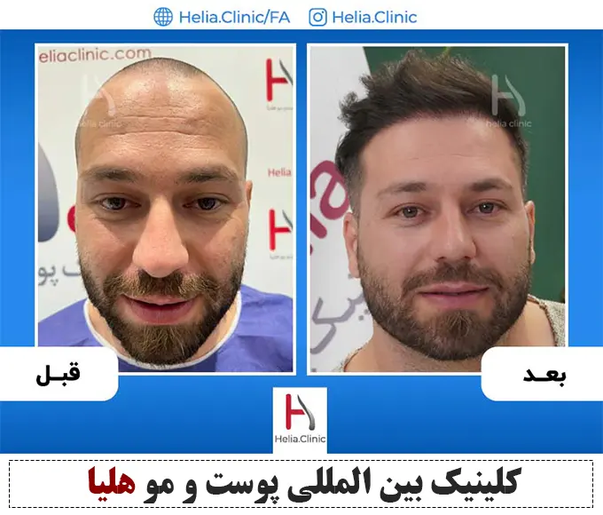 https://akharinnews.com/images/1403/03/15/%DB%B3%DB%B3%DB%B3.png