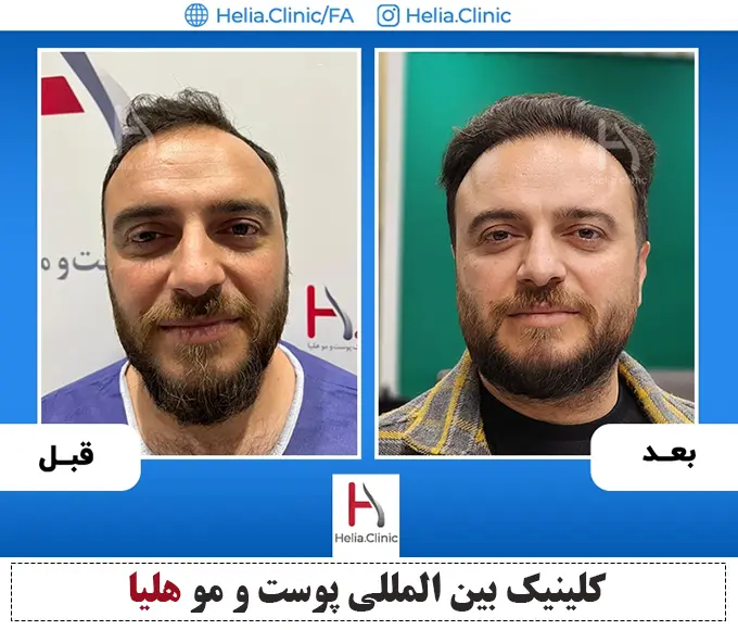 https://akharinnews.com/images/1403/03/15/%DB%B4%DB%B4%DB%B4.png