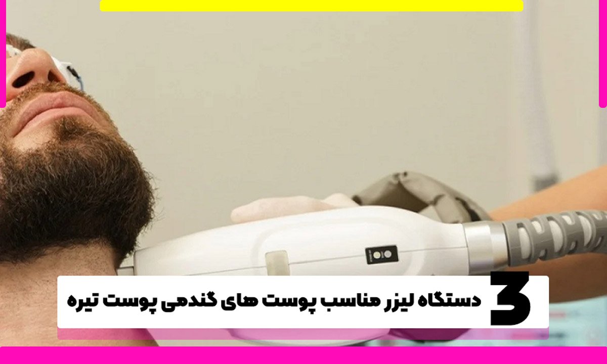 دستگاه‌ لیزر مناسب پوست های گندمی پوست تیره