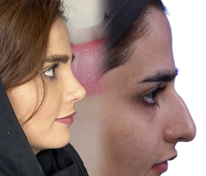 بهترین جراح بینی در کرج
