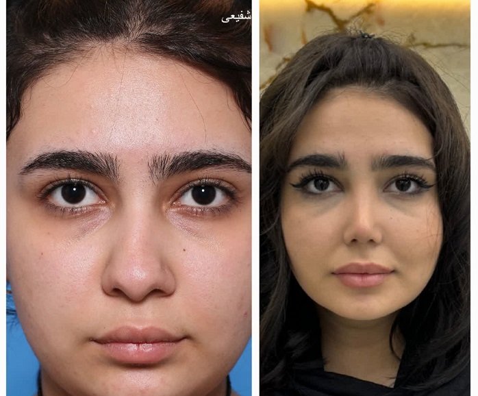 بهترین جراح بینی کرج