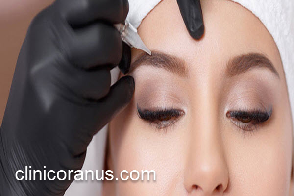 کدام کلینیک برای کاشت ابرو معتبر است؟ | کلینیک اورانوس