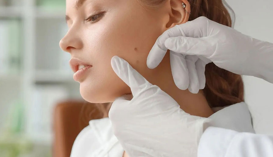 راهکارهای خانگی برای حذف و محو کردن خال روی صورت