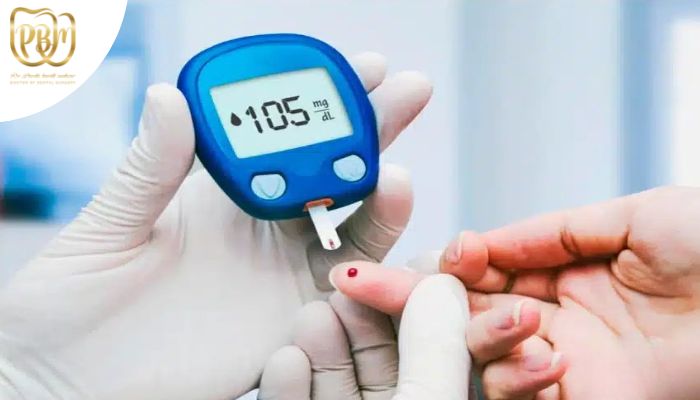 شرایط لازم برای انجام ایمپلنت در افراد دیابتی