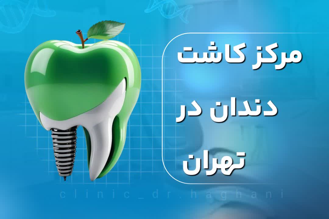 مرکز کاشت دندان