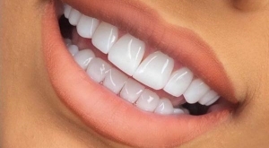 اگر از رنگ کامپوزیت دندانم راضی نیستم چه کنم؟