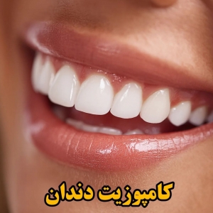 کامپوزیت دندان چیست؟ (۴ تفاوت اصلی کامپوزیت و لمینت)